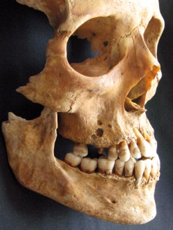 Medieval skull